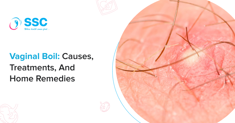 Vaginal Boil: Pictures, Causes, Treatments, and Home Remedies