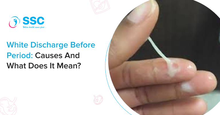 White Discharge Before Period